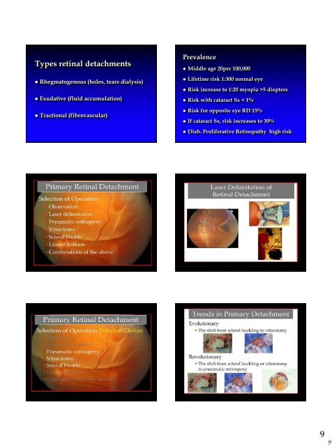 Retinal Detachment - Kontaktlinse Instituttet