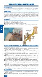 ALR - Bloc infraclaviculaire - Mapar