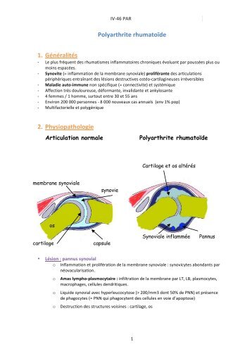 IV-46 Polyarthrite rhumatoide(P) - PharmaEtudes