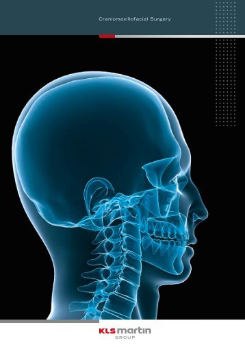 Craniomaxillofacial Surgery - LJ Medical