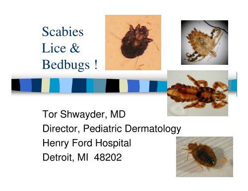 Scabies Lice &amp; Bedbugs !