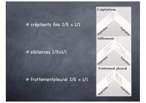 semiologie respiratoire - ammppu