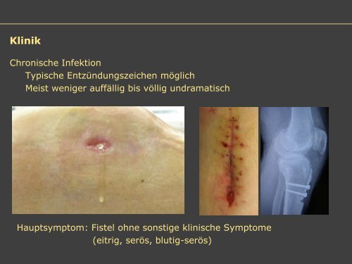 Dr. Matthias Buehler, postoperative Infektion - Septische Chirurgie