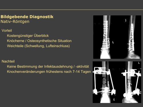 Dr. Matthias Buehler, postoperative Infektion - Septische Chirurgie