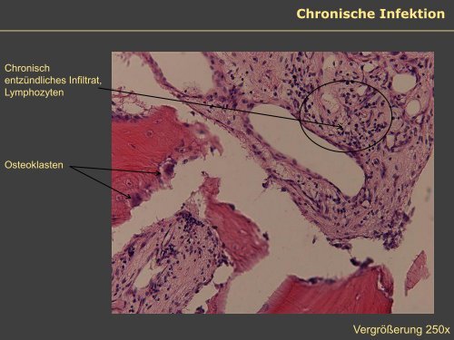 Dr. Matthias Buehler, postoperative Infektion - Septische Chirurgie