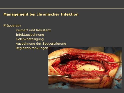 Dr. Matthias Buehler, postoperative Infektion - Septische Chirurgie