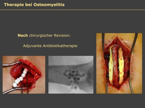 Dr. Matthias Buehler, postoperative Infektion - Septische Chirurgie