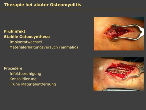 Dr. Matthias Buehler, postoperative Infektion - Septische Chirurgie