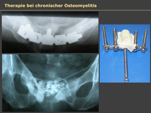 Dr. Matthias Buehler, postoperative Infektion - Septische Chirurgie