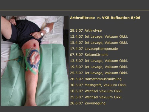 Dr. Matthias Buehler, postoperative Infektion - Septische Chirurgie