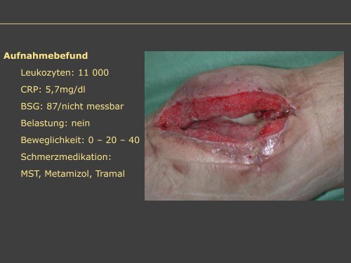 Dr. Matthias Buehler, postoperative Infektion - Septische Chirurgie