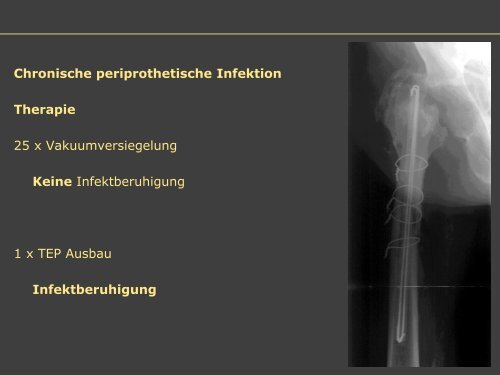 Dr. Matthias Buehler, postoperative Infektion - Septische Chirurgie