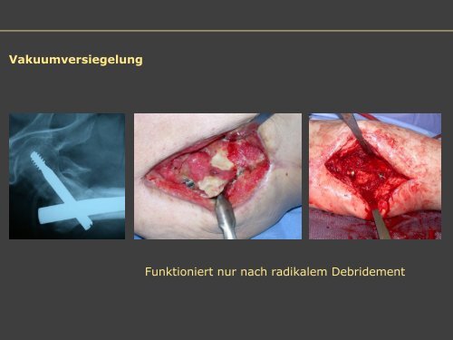 Dr. Matthias Buehler, postoperative Infektion - Septische Chirurgie