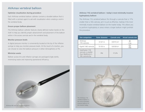 AVAmax kyphoplasty brochure - CareFusion