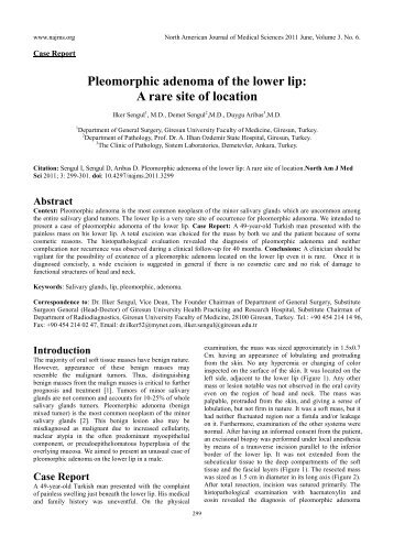 Pleomorphic adenoma of the lower lip - North American Journal of ...