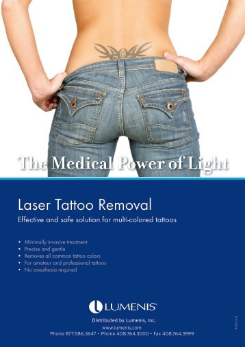 Tattoo Removal Brochure - Lumenis Aesthetic