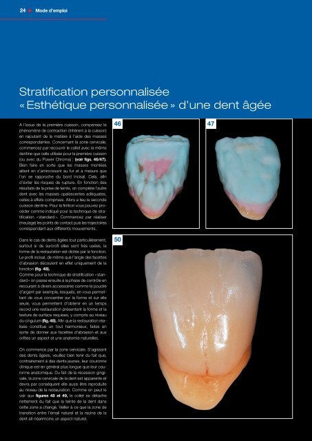 CerconÂ® ceram kiss - DeguDent