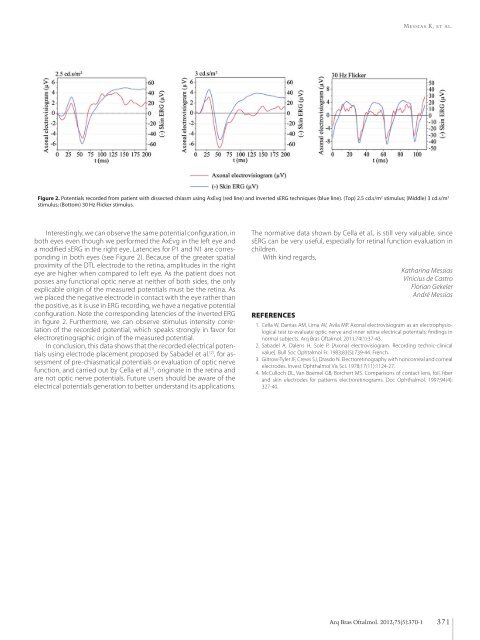 Ocular rosacea Crotoxin for paralysis of extraocular muscles ...