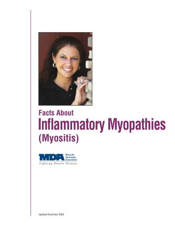 Facts About Inflammatory Myopathies (Myositis) - Muscular ...