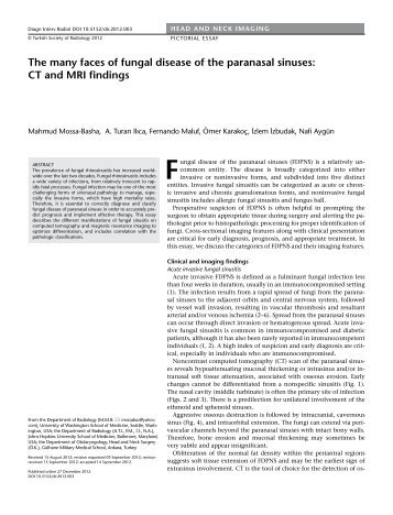 The many faces of fungal disease of the paranasal sinuses: CT and ...