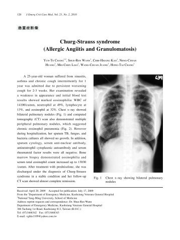 Churg-Strauss syndrome (Allergic Angiitis and Granulomatosis)