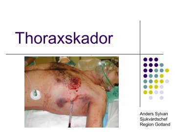 Thoraxskador