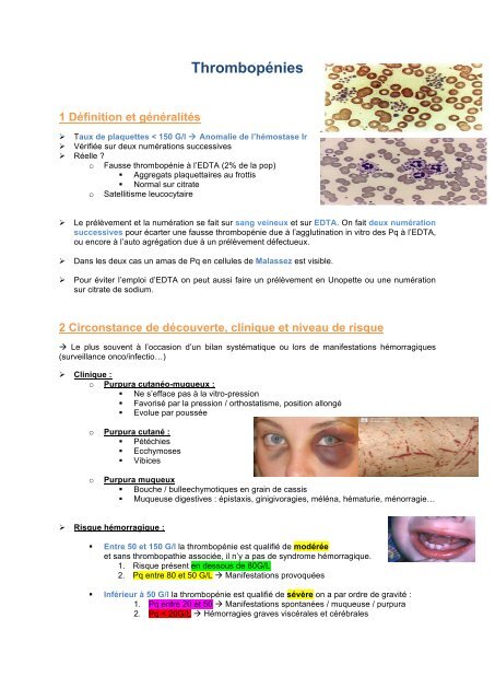 31-ThrombopÃ©nies - PharmaEtudes