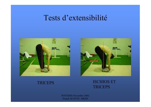 Les ischios-jambiers dans le sprint - Entrainement-sportif