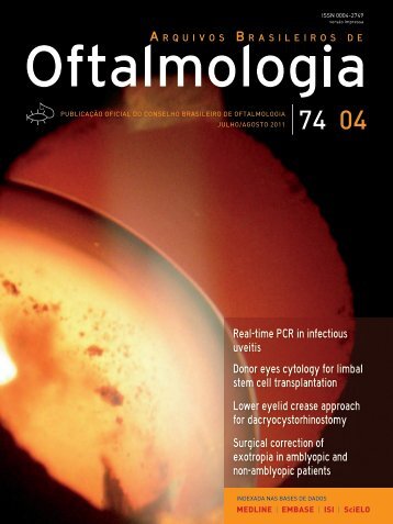 Real-time PCR in infectious uveitis Donor eyes - Conselho ...