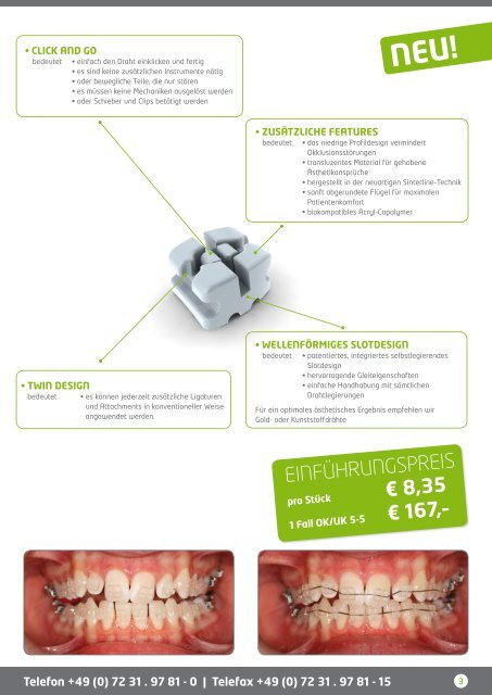 sonDeRAnGeBot - Dentalline