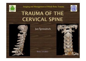 Trauma of the cervical spine - AKUTNE.CZ