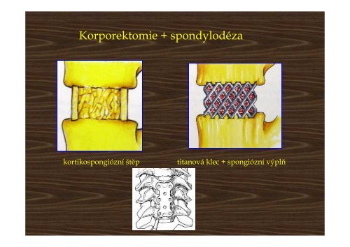 Trauma of the cervical spine - AKUTNE.CZ