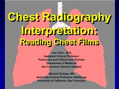 Basic CXR Interpretation - EthnoMed