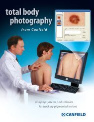 total body photography