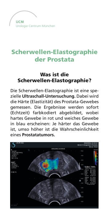 Scherwellen-Elastographie der Prostata