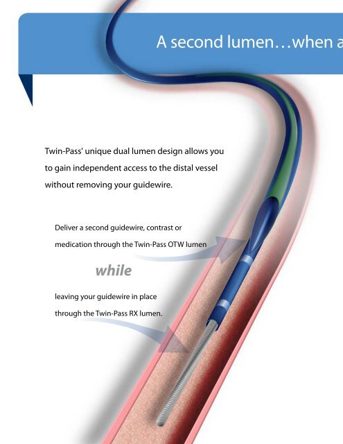 Twin-Pass Brochure - Vascular Solutions, Inc.