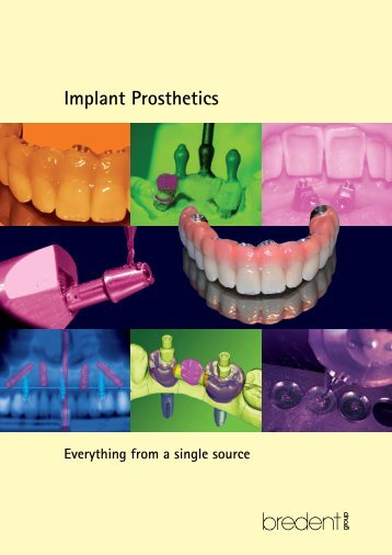 Implant Prosthetics download pdf - Bredent.co.uk