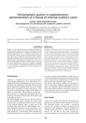 Perilymphatic gusher in stapedectomy - Acta Otorhinolaryngologica ...