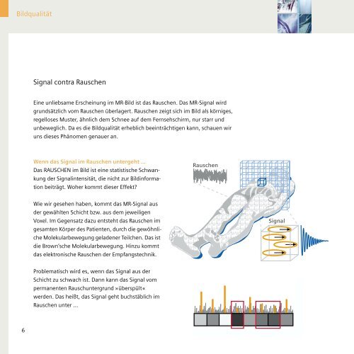 Magnete, Fluss und Artefakte - Siemens Healthcare