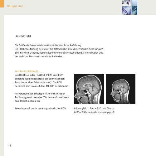 Magnete, Fluss und Artefakte - Siemens Healthcare