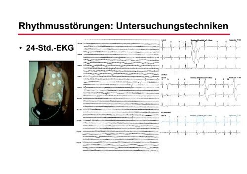 RhythmusstÃ¶rungen: Untersuchungstechniken - Prof-wendt.de