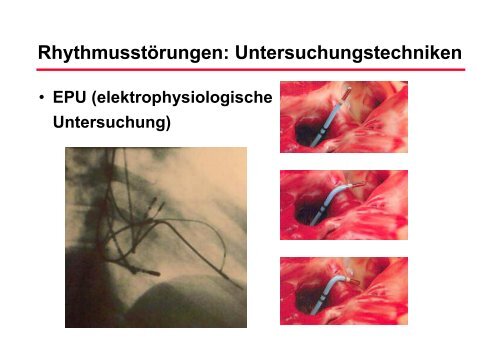 RhythmusstÃ¶rungen: Untersuchungstechniken - Prof-wendt.de