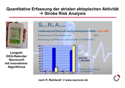 RhythmusstÃ¶rungen: Untersuchungstechniken - Prof-wendt.de