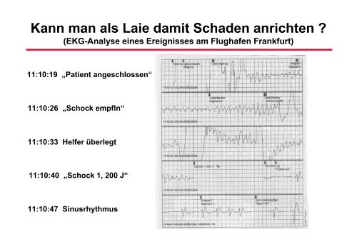 RhythmusstÃ¶rungen: Untersuchungstechniken - Prof-wendt.de