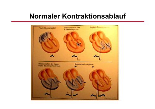 RhythmusstÃ¶rungen: Untersuchungstechniken - Prof-wendt.de