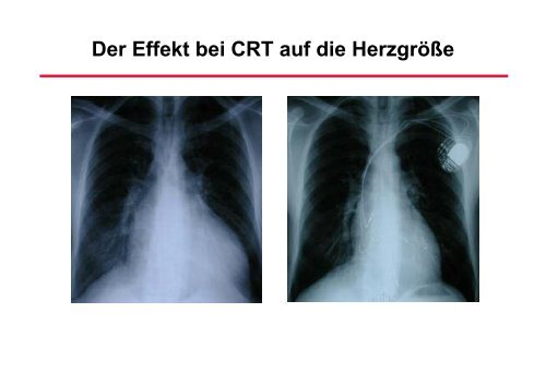 RhythmusstÃ¶rungen: Untersuchungstechniken - Prof-wendt.de