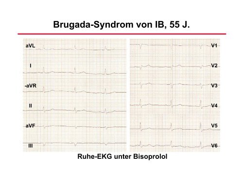 RhythmusstÃ¶rungen: Untersuchungstechniken - Prof-wendt.de