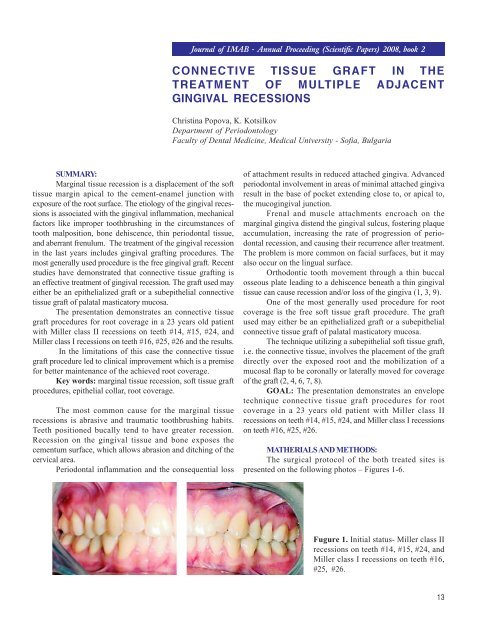 CONNECTIVE TISSUE GRAFT IN THE ... - Journal of IMAB