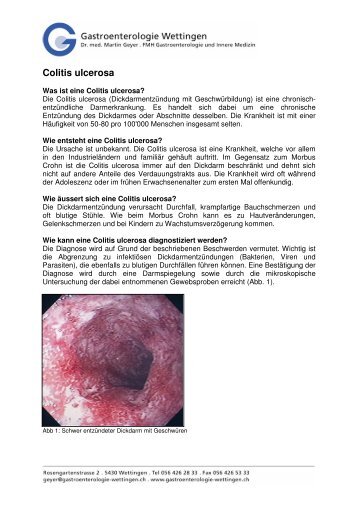 Merkblatt Colitis ulcerosa - Gastroenterologie-wettingen.ch