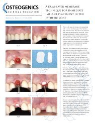 A dual-layer membrane technique for immediate ... - Osteogenics